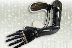 14ELMT Custom IST Prosthesis