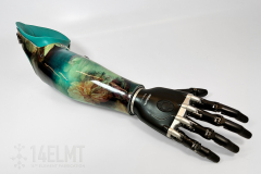 'Bayou Princess' Transradial Prosthesis