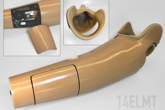 Custom TR Prosthesis with Stashbox Feature