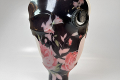 Custom Rose AK Prosthesis