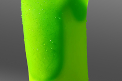 Green Transfemoral Prosthetic Socket