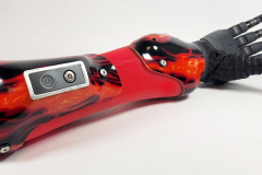 This custom partial hand prosthesis features a carbon fiber frame with flame design and a silicone socket with ELASTO-fit to ease donning & doffing. Paired with a TASKA Hand.